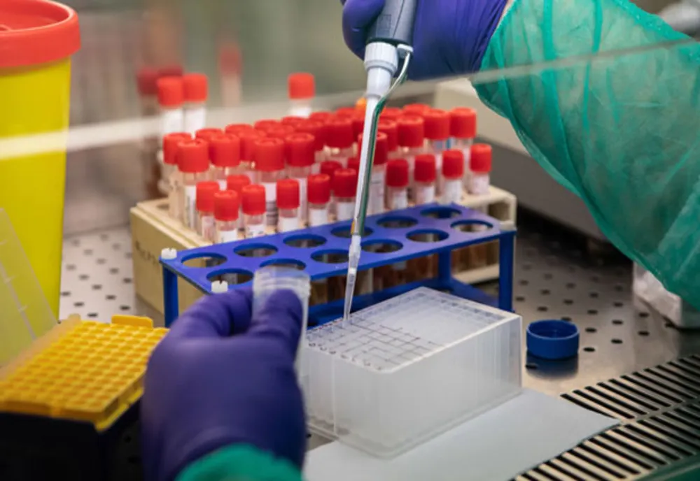 Dolj: Spitalul de „Infecțioase” mai are 473 de teste disponibile 