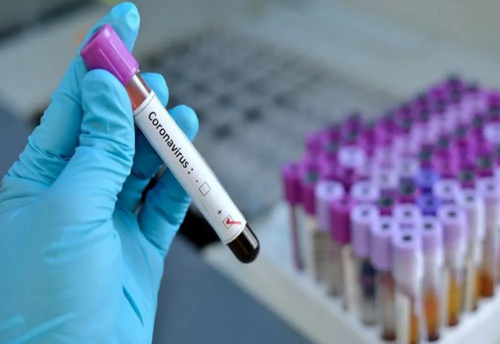 Asistenta șefă a Căminului pentru Persoane Vârstnice Craiova, infectată cu coronavirus