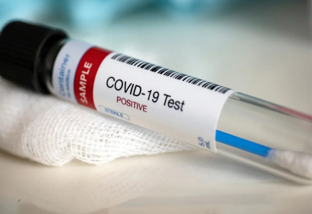 158 de cazuri noi de coronavirus, în Dolj
