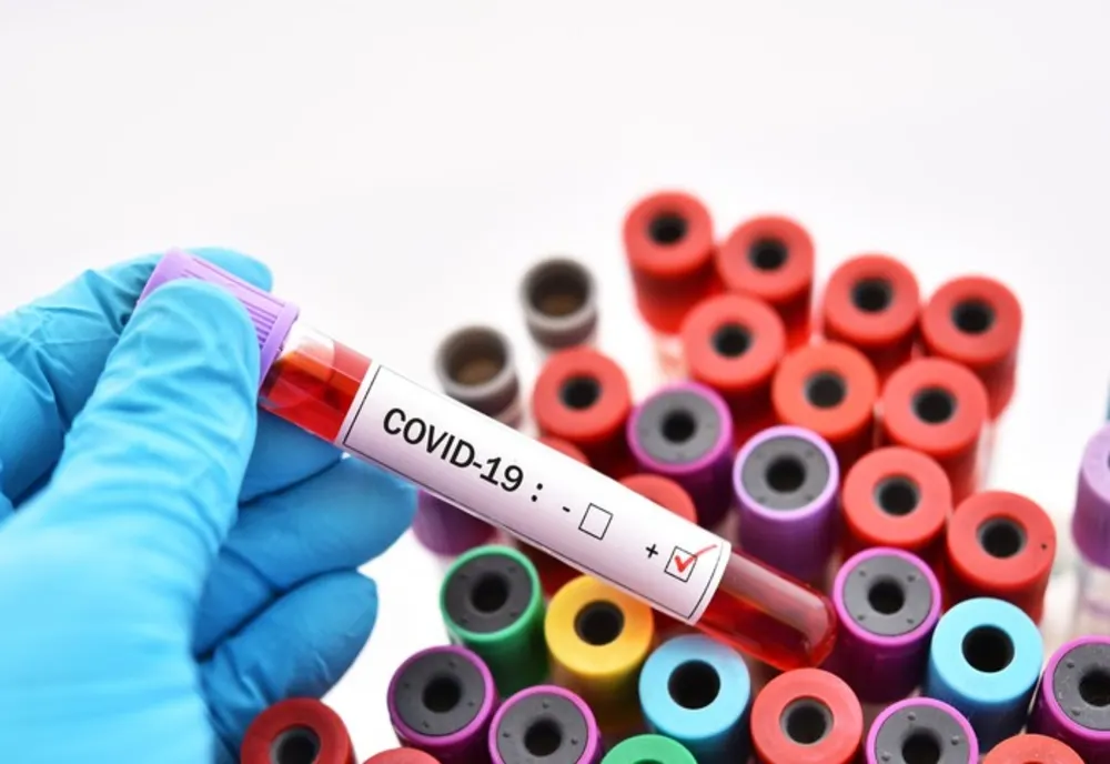Carantină pentru angajații firmei de închirieri auto, de la Craiova, care au intrat în contact cu italianul depistat cu coronavirus