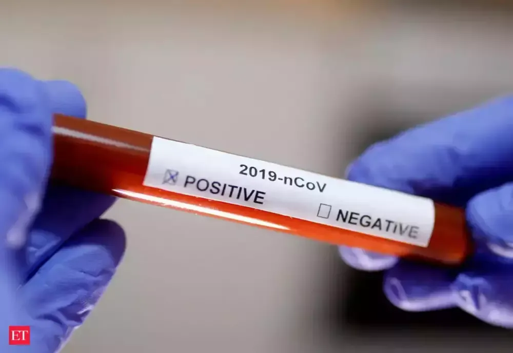 Dolj: Alți 13 jandarmi craioveni au fost depistați cu coronavirus  