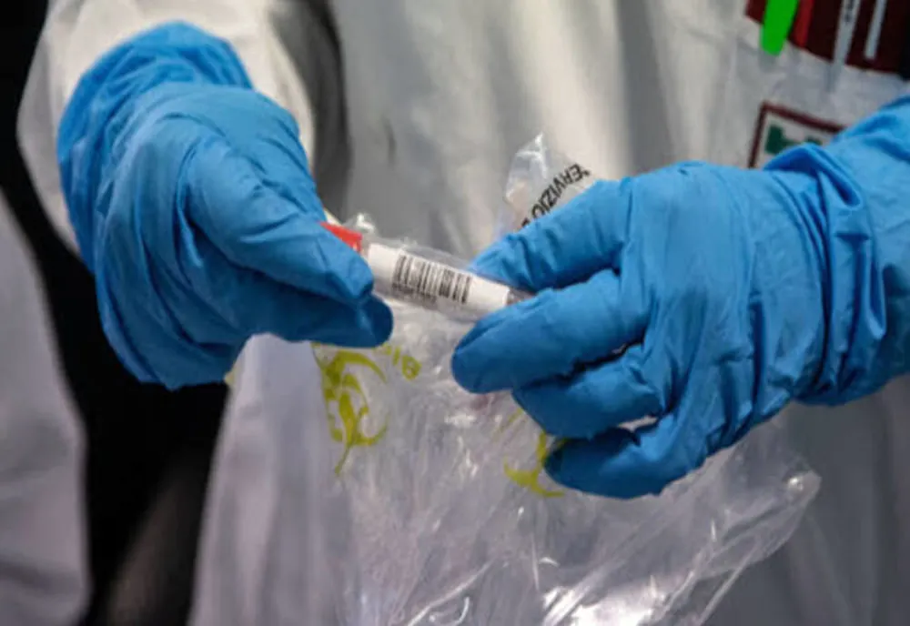 Doar cinci cazuri noi de coronavirus, în Dolj, în ultimele 24 de ore