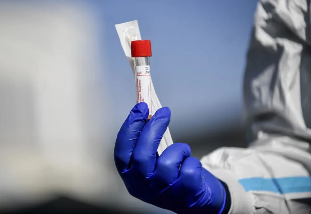O nouă zi cu peste 10.000 de infectări cu SARS-CoV2. Raport pe fiecare judeţ