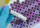 Al treilea doljean depistat cu noul coronavirus