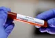 Covid-19: O femeie internată la Spitalul de Boli Infecțioase Craiova a decedat 