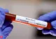 Dolj: Alți 13 jandarmi craioveni au fost depistați cu coronavirus  