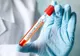 O altă gafă marca DSP Dolj: Oameni scoși din carantină fără rezultat la testarea pentru coronavirus. După mai bine de o săptămână au aflat că sunt infectați cu noul virus