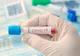 Coronavirus | Focare în creştere, în judeţul Dolj