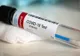 158 de cazuri noi de coronavirus, în Dolj