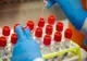Dolj: 53 de cazuri noi de coronavirus. La cât a ajuns bilanţul